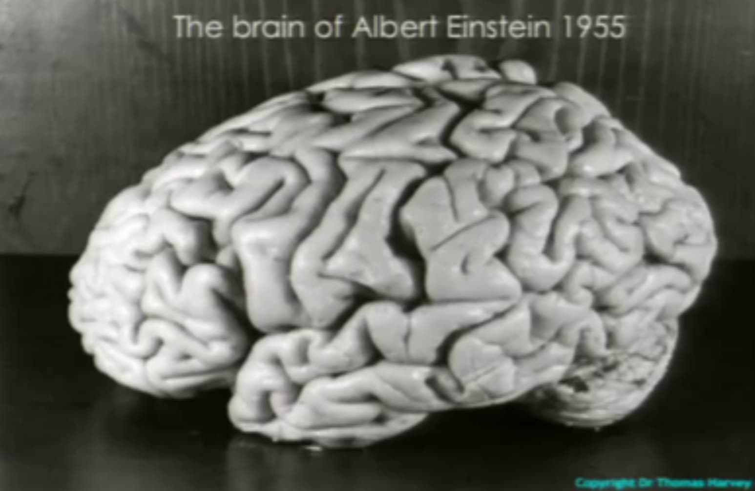 einstein brain - The brain of Albert Einstein 1955 Capy Thomas Har